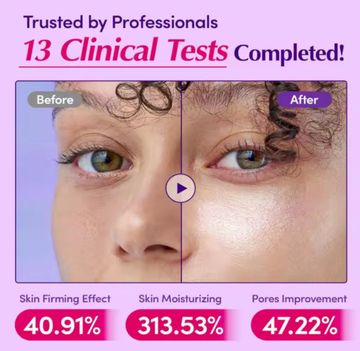 Bakuchiol Retinol Alternative + Niacinamide + Vitamin C Serum Set – Pore Shrinking, Wrinkle Reducing, Skin Lifting Glow Trio 2025