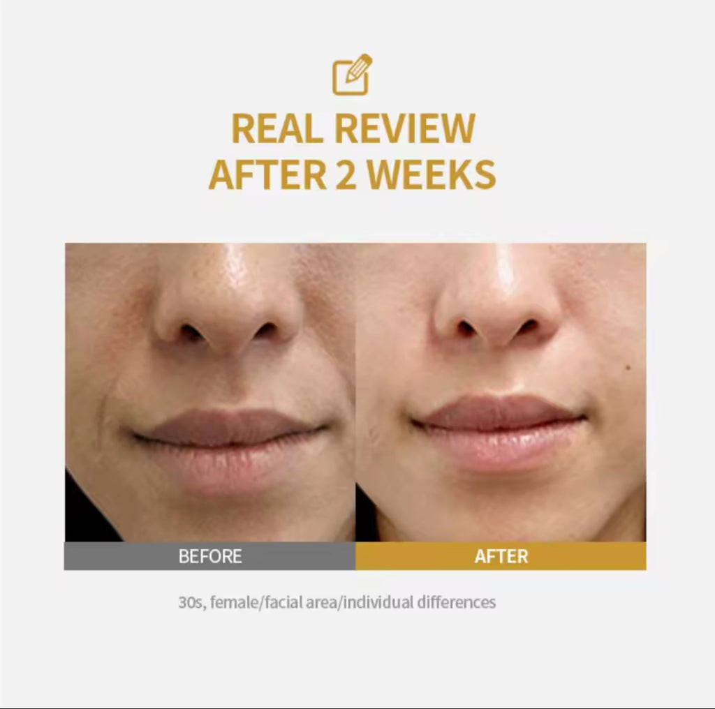 Peptide Intensive Lifting Ampoule,Deep Collagen Face Firming Moisturizing Serum,Glass Skin Tightening Hydration,Korean Skincare