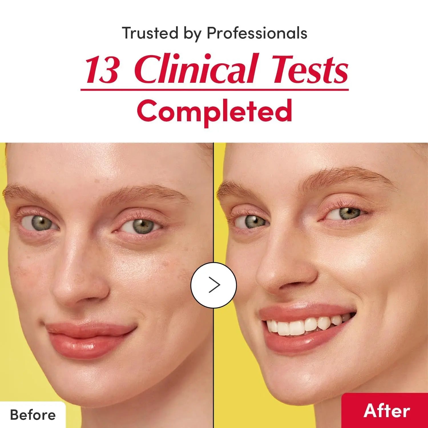 Bakuchiol Retinol Alternative + Niacinamide + Vitamin C Serum Set – Pore Shrinking, Wrinkle Reducing, Skin Lifting Glow Trio 2025