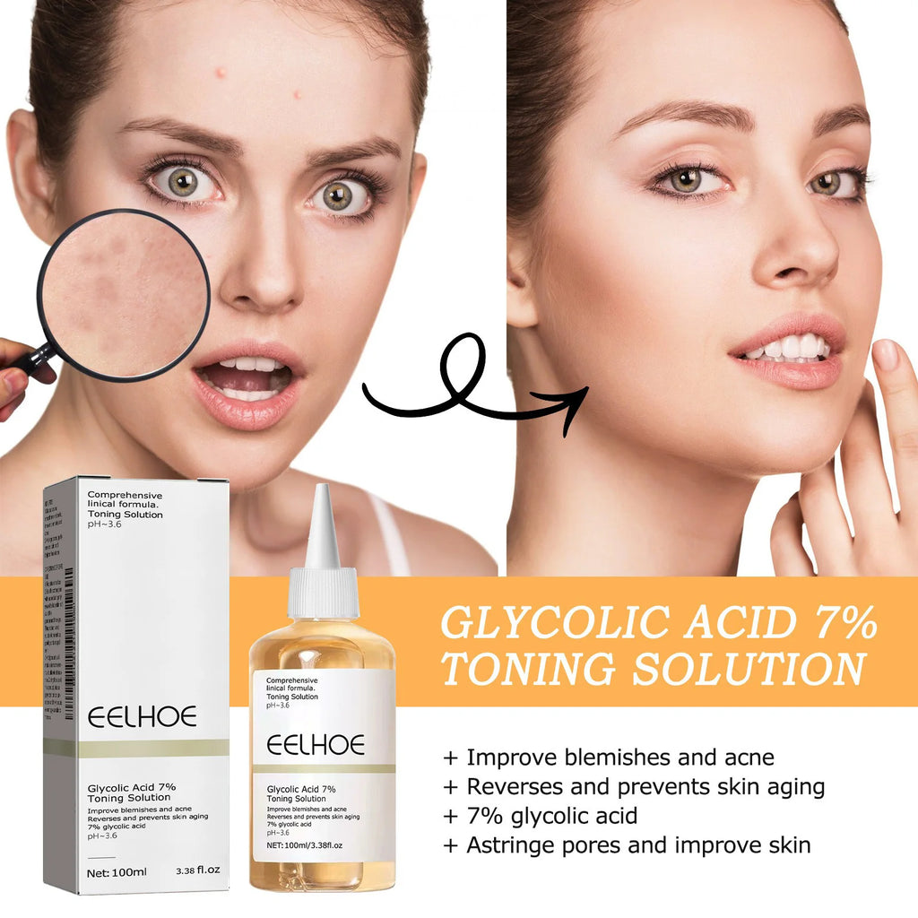 Glycolic Acid 7% Toning Solution – Acne Remover, Wrinkle Lifting, Firming Glowing Skin Toner 2025